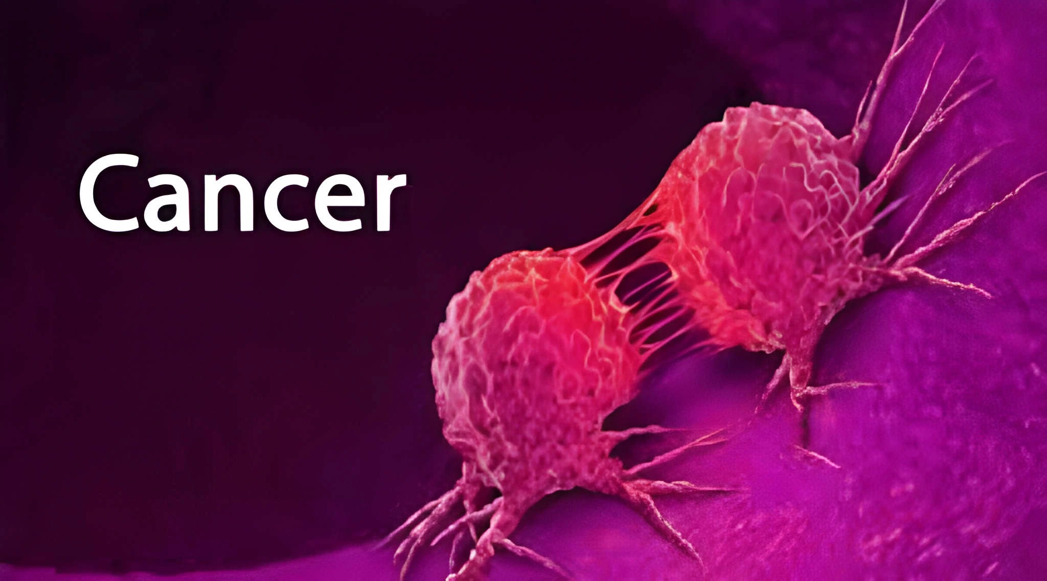 پانچ-خطرناک-بیماریوں-سے-تحفظ-دینے-والی-غذا