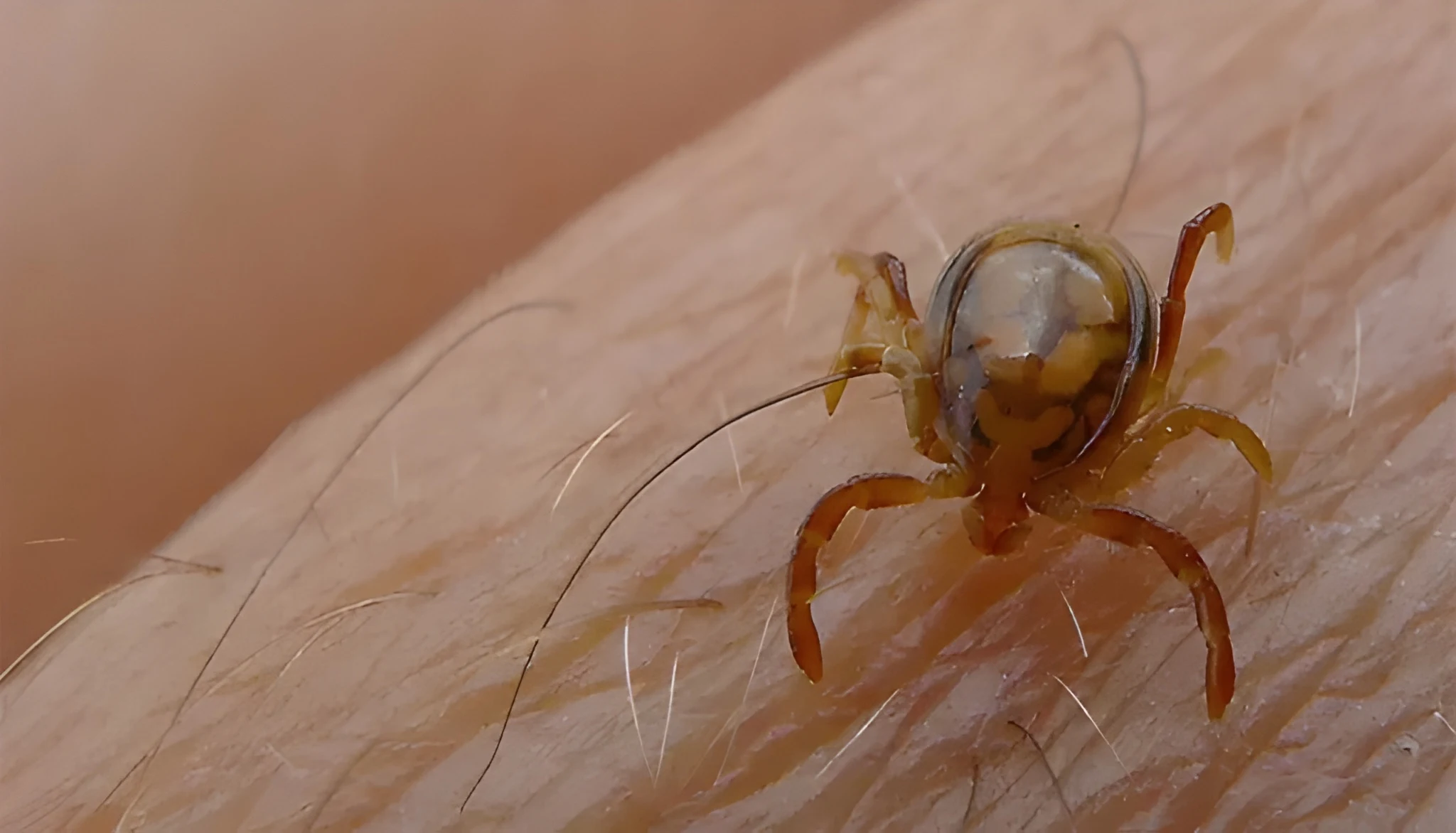 سندھ میں کانگو وائرس کا پہلا کیس رپورٹ، محکمہ صحت الرٹ