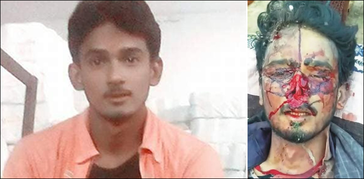 پسند-کی-شادی-پر-لڑکی-کے-بھائیوں-نے-نوجوان-کی-ناک-کاٹ-دی