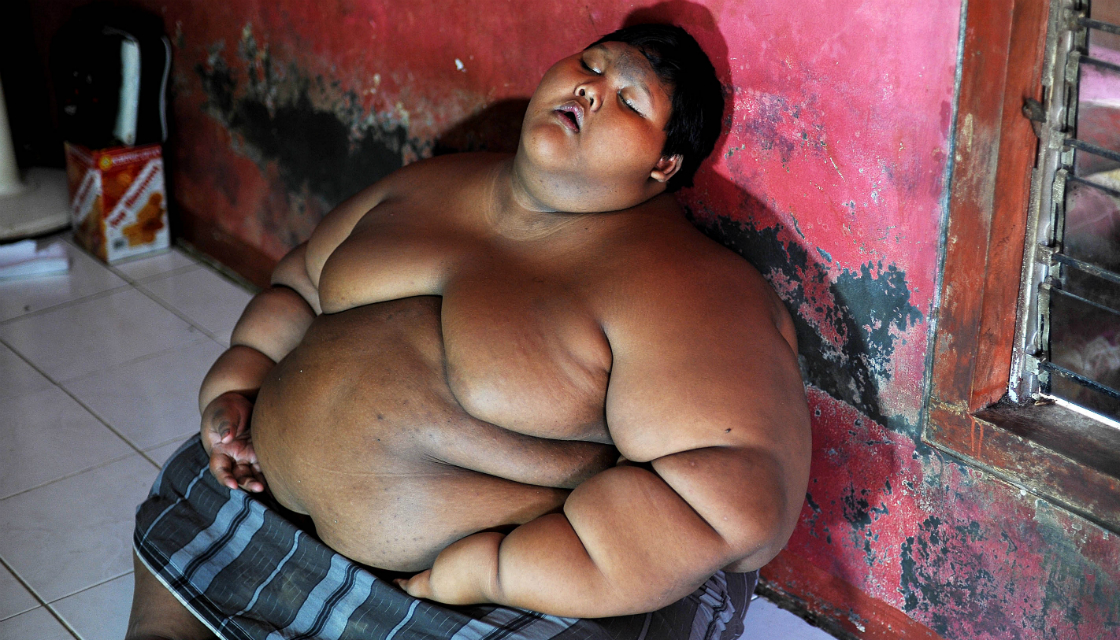 world-fattest-kid