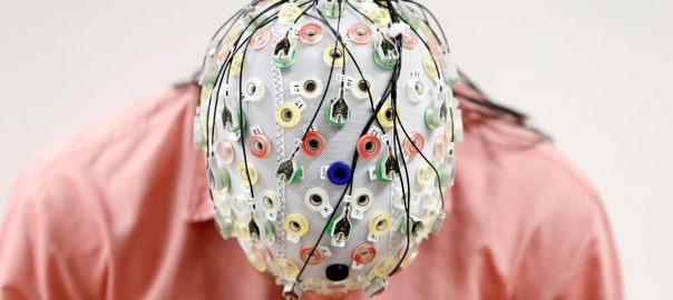 electrical-brain-stimulation-can-boost-memory-function-in-older-people