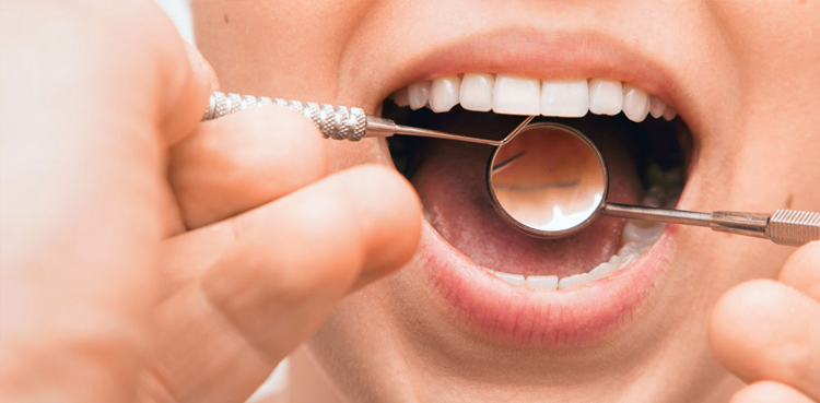 woman-grows-eye-lash-like-hairs-out-of-her-gums